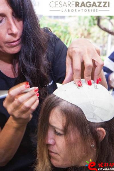 另類治療脫發(fā)的最好方法 用3D打印超逼真假發(fā)解決困擾 治療脫發(fā)不再煩,3d打印頭發(fā),假發(fā)3d模型,3d打印材料,3d打印服務,3d打印廠家