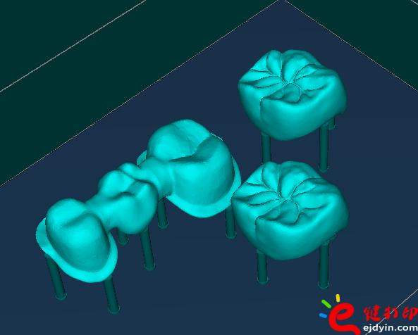3d打印牙齒價(jià)格,3d打印牙齒模型,3d打印牙齒臨床了嗎,3d打印牙齒價(jià)格表,3d打印牙齒能用多久