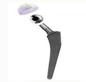 股骨金屬植入物4